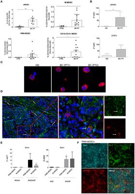 SPARC Is a New Myeloid-Derived Suppressor Cell Marker Licensing Suppressive Activities